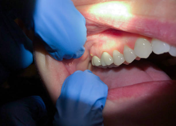 Best Emergency Cosmetic Dentistry in Six Mile Run, NJ
